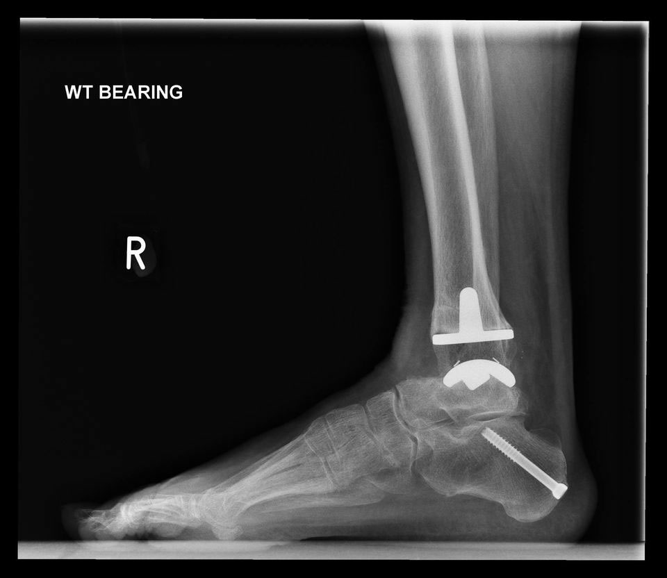 arthroplastiki-podoknimikis_inside https://ballas.gr/wp-content/uploads/2023/07/arthroplastiki-podoknimikis_inside.jpg